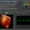 ECG Exhibit 
